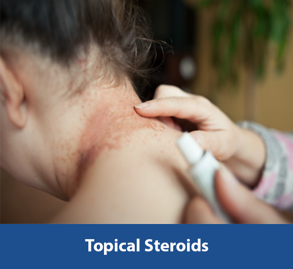 Topical-Steroids 1